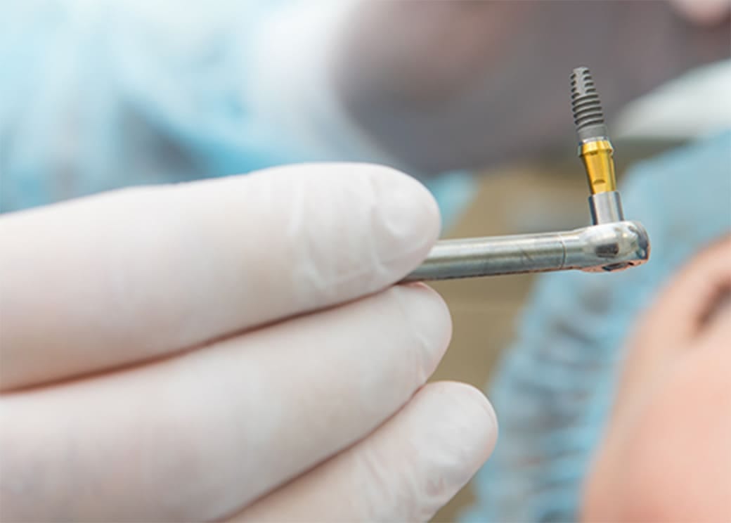 歯医者が怖すぎて、えずいてしまう。安心してインプラントをしたい。